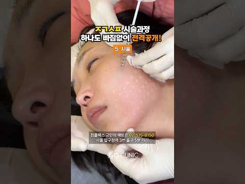 줄기세포 시술 과정 전격 공개!! #815클리닉 #줄기세포