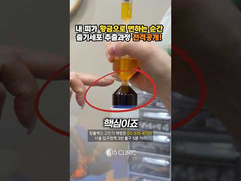 줄기세포 시술 과정 전격 공개 #815클리닉 #줄기세포