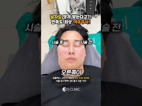 남자에게도 좋은 ‘여우주사’ #815클리닉 #남자피부관리