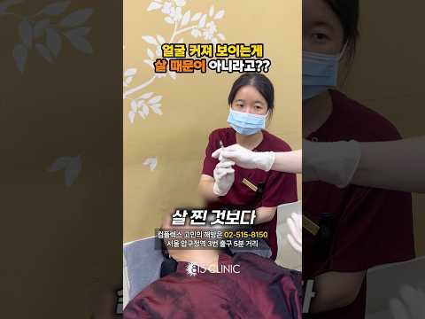얼굴이 커진 이유 살 때문만은 아니에요! #턱보톡스 #815클리닉