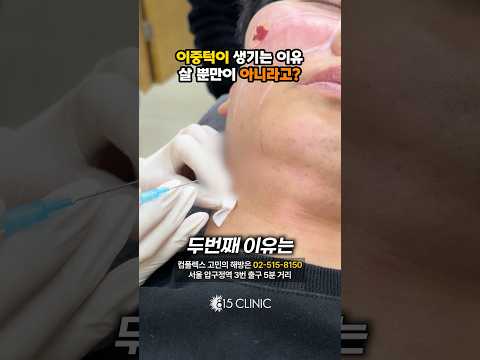당신이 이중턱이 된 이유는!? #815클리닉 #이중턱 #울쎄라