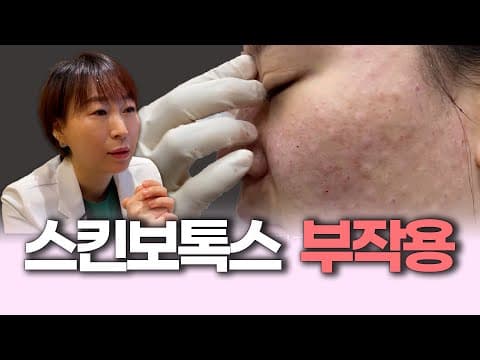 Don't Get Skin Botox Just Anywhere