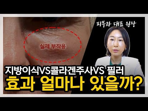 Fat Transfer vs Collagen vs Filler Comparison