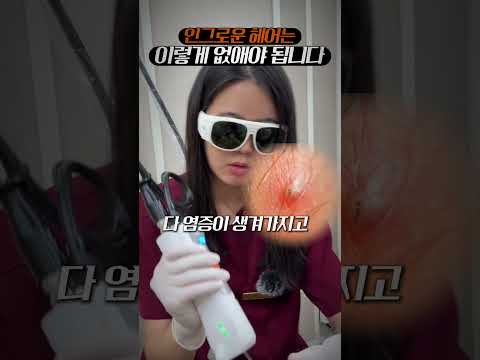 인그로운 헤어, 손으로 떼면 큰일 납니다