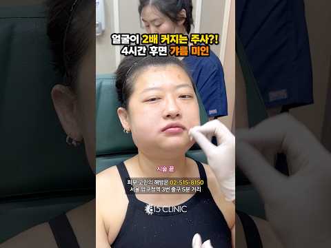 왜 이렇게 부풀었을까요? #여우주사 #815클리닉