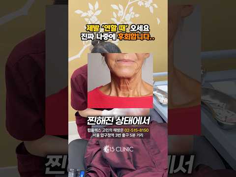 주름은 타이밍이 중요해요! 찐해지기 전에 오세요! #주름개선 #815클리닉 #압구정피부과