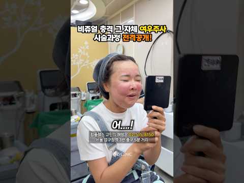 비쥬얼 충격 여우주사 시술 직후 #815클리닉 #여우주사