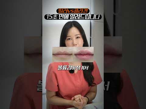필러 vs 콜라겐필러 차이 궁금하시지 않으세요?