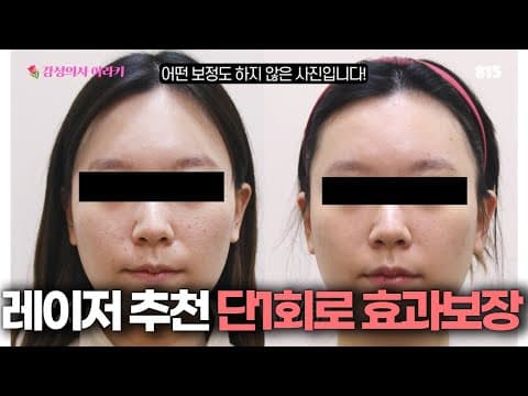 단 1회만으로도 효과있는 레이저가 있다?!