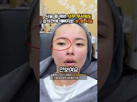 하자마자 달라지는 눈밑 시술 #815클리닉 #눈밑시술